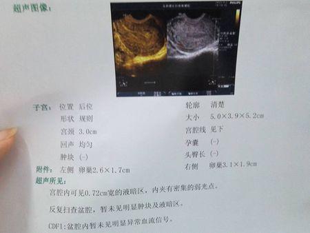 《伤到最后》(张天龙)歌词555uuu下载